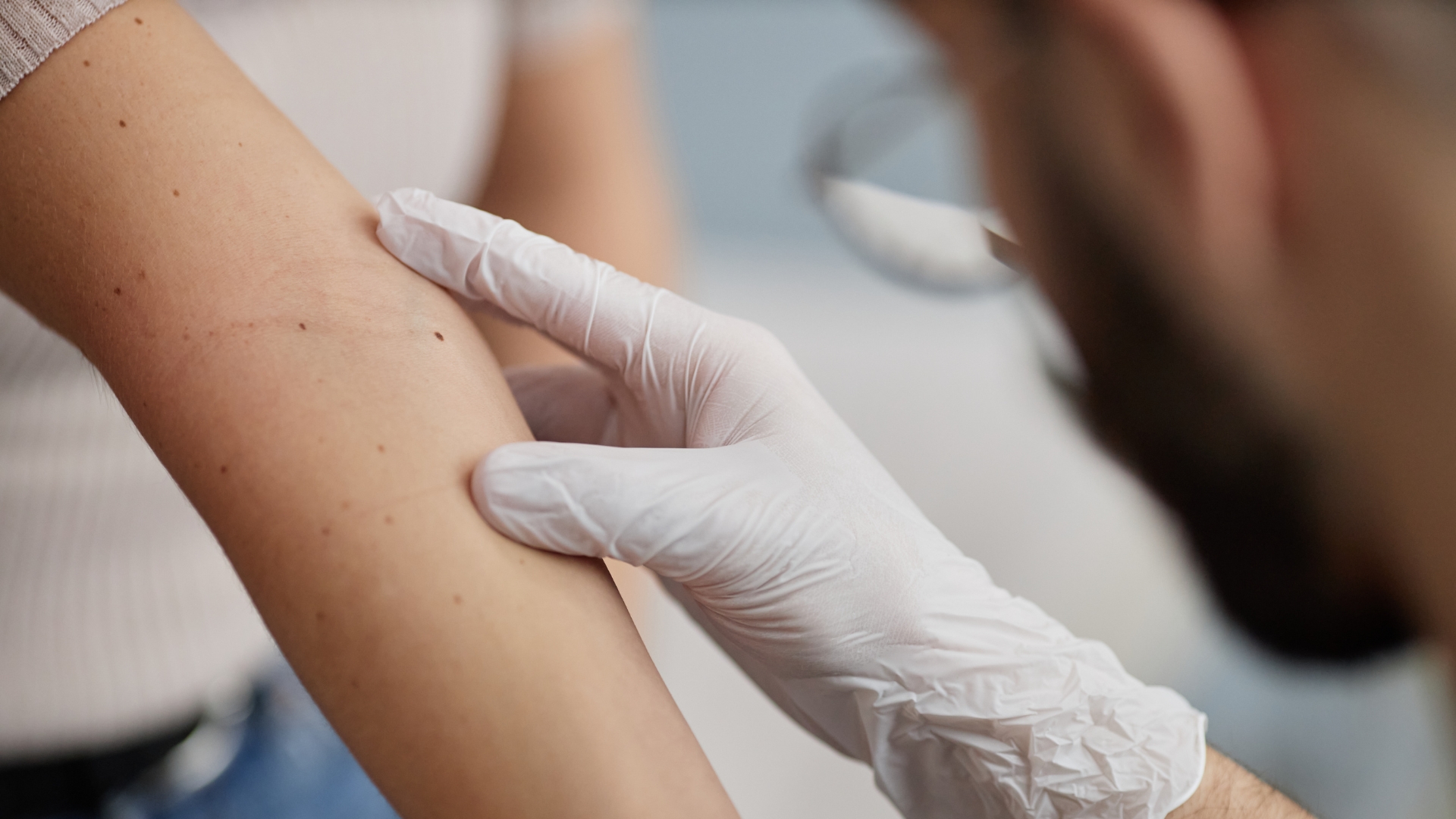 Doctor examining a mole on a patient's shoulder with a dermatoscope during a skin cancer check